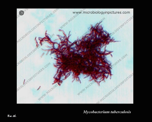 acid-fast stain, mycobacterial culture specimen